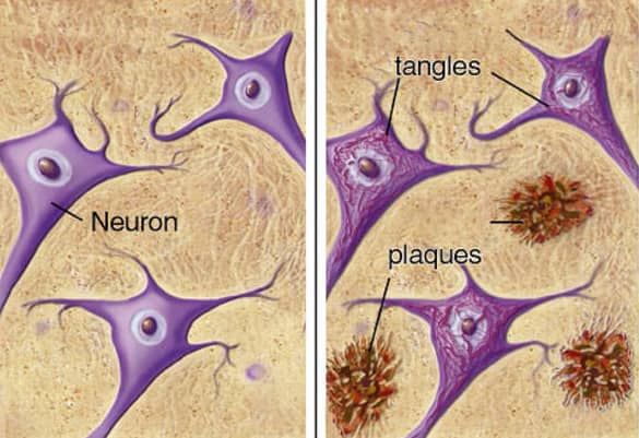 causes