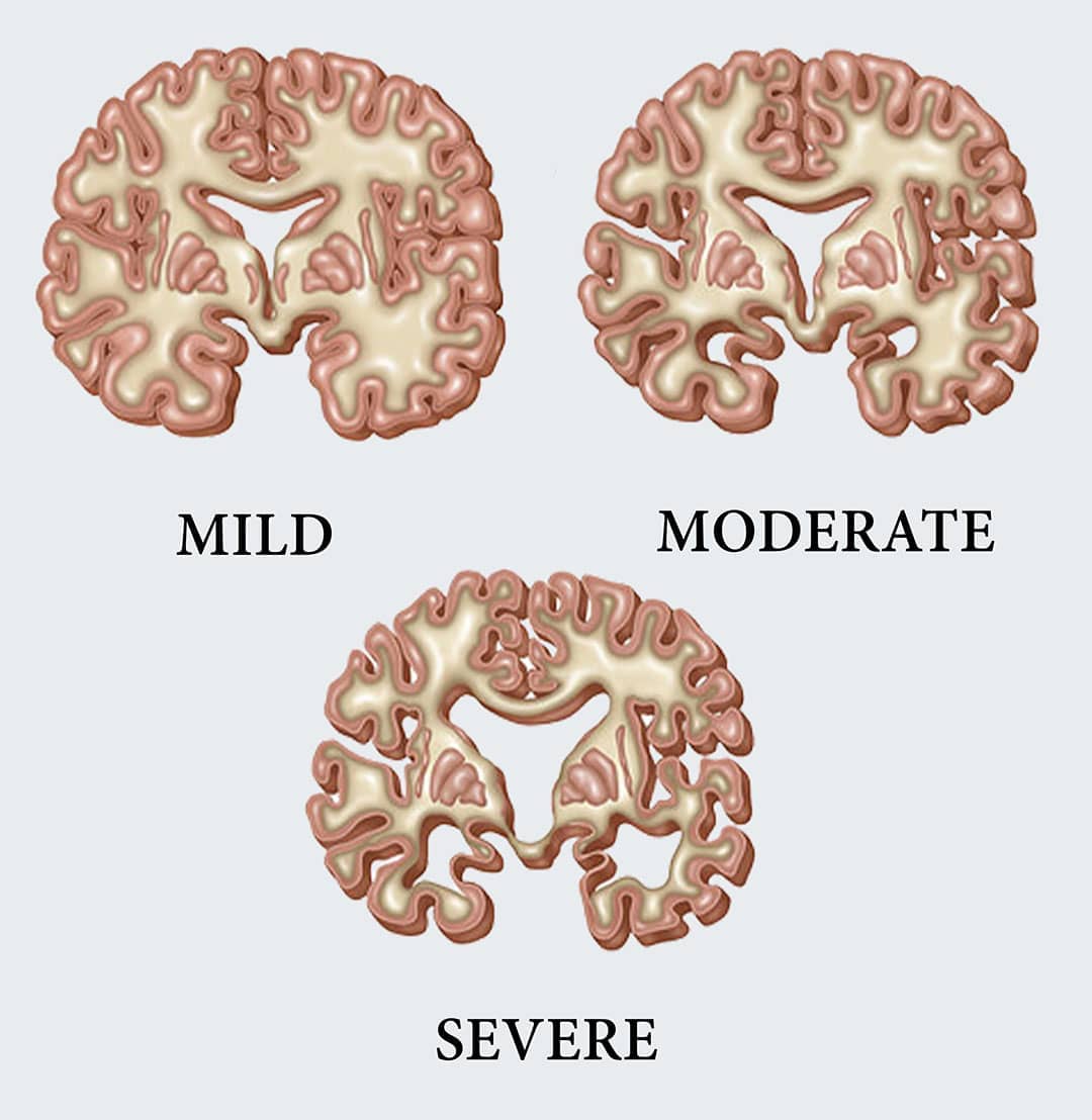 stages